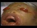 Bebe-Malformado-que-
