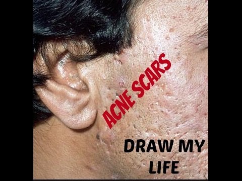 how to draw scars