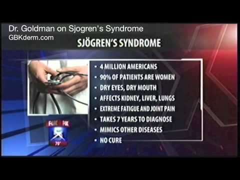 how to treat sjogren's syndrome
