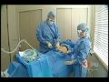 Laser Liposuction | SmartLipo | Dr. Todd Malan