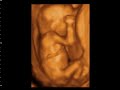 Bebe 15 semanas Bebe 15 semanas