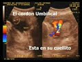 Ecografia de nuestra bebita