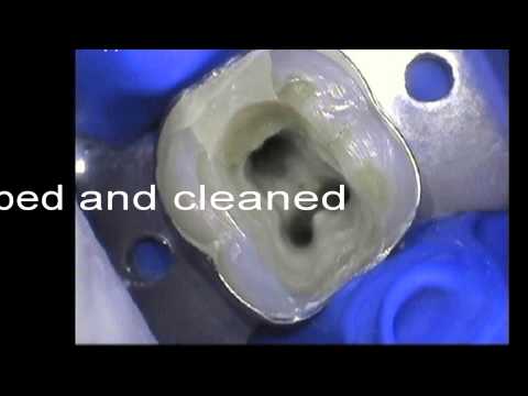 how to isolate tooth pain
