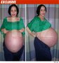 Pictures of Octo-Mom's Pregnant Stomach