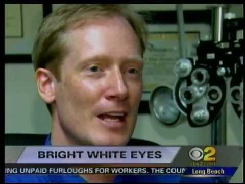 how to whiten sclera of eyes naturally