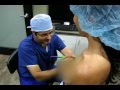 Breast Enlargement Beverly Hills - Plastic Surgery Before and After