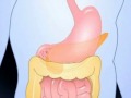 Diabetes Basics: What Is Diabetes?