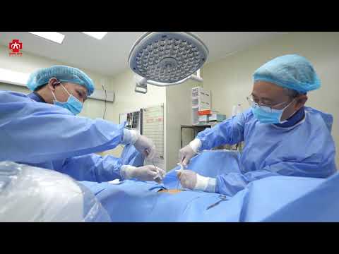 Bơm xi măng sinh học: Giải pháp tiên tiến điều trị...