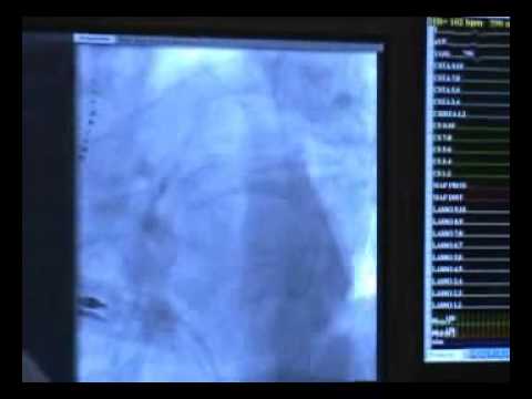 how to drain lower sinuses