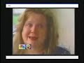 Manipulation Under Anesthesia - MUA in the News