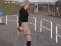 amputee christine 4