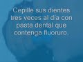 Prevencion en salud bucal, selladores de fosetas y fisuras Prevencion en salud bucal, selladores de fosetas y fisuras
