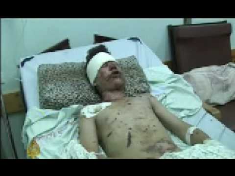 Image de prévisualisation YouTube