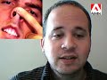 Breaking YouTube News - July 4th 2007