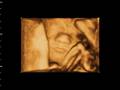videos de Benjamin Knudson