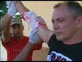 Dicas que Salvam - Parte 5 - Hemorragias Dicas que Salvam - Parte 5 - Hemorragias