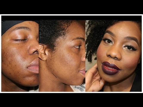 how to care black skin