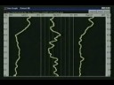 Dr. Amalu on Chiropractic Thermography 2/3 Dr. Amalu on Chiropractic Thermography 2/3