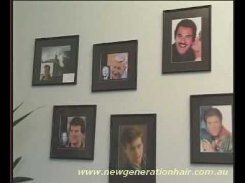 Hair Loss Treatment Sydney Video 0 Hair Loss Treatment Sydney Video