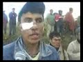 Herido en el ojo 64K