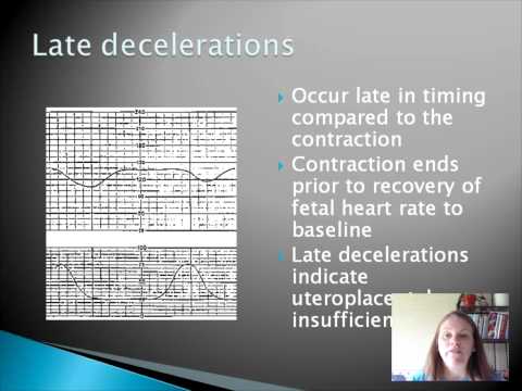 how to assess newborn heart rate