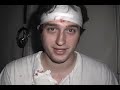 12: Loopy on Morphine 12: Loopy on Morphine