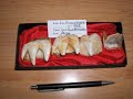Noticia Audio 10 - Molars de Rino