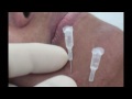 Dr. Helder Madeley  homeopunctura acupunctura facial