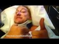 The Dudesons in America Official Trailer