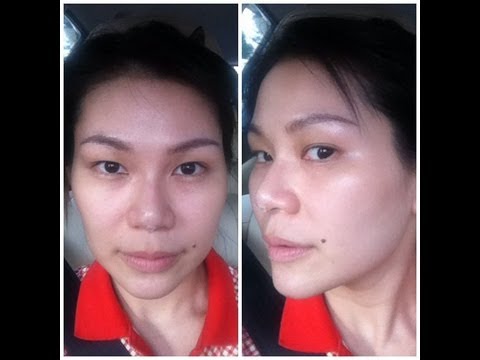ฉีดจมูก -