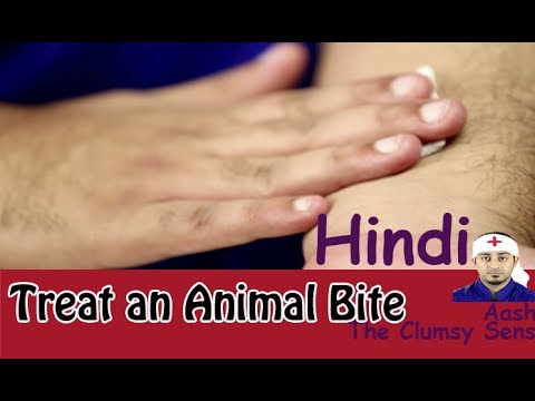 how to treat dog bite
