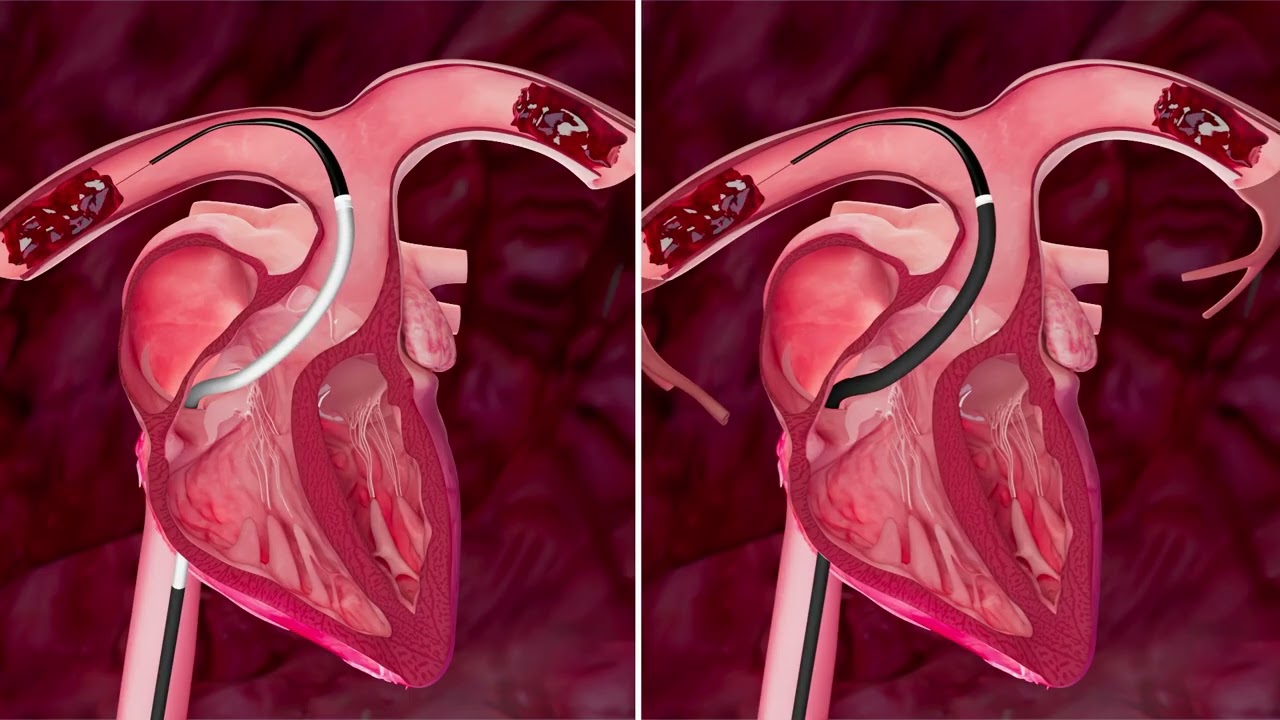 PE Procedural Animation