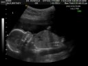 MY GIRL....ULTRASOUND VIDEO