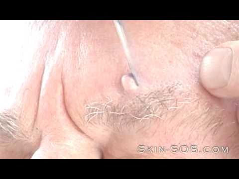 small vagina lips
