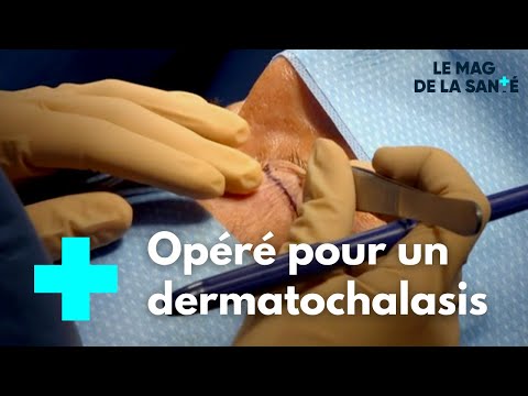 Vignette d'aperçu de la vidéo