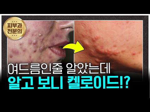 연세스타피부과 TV