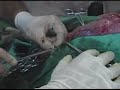 Veterinarian performing a cesarean on a dog (Part 5)