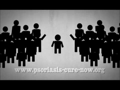 Psoriasis Cure Now PSA