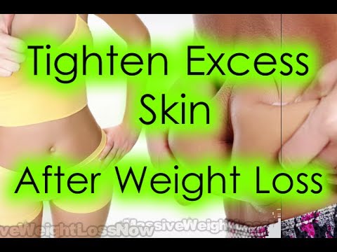 how to lose excess skin