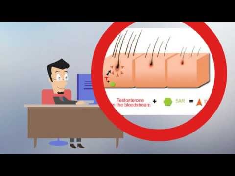 how to treat acne caused by vyvanse