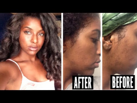 how to care black skin