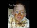 Preeclampsia journey....our 1lb 4oz 29wk severe IUGR preemie