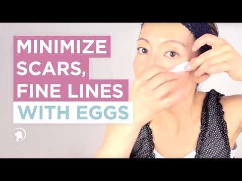 how to treat eggshell nails