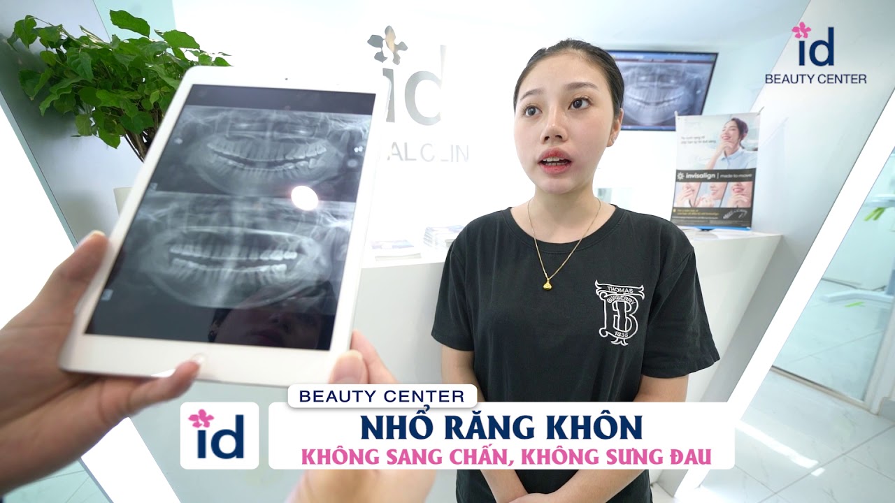 Nhổ Răng khôn | Không sang chấn, không sưng đau