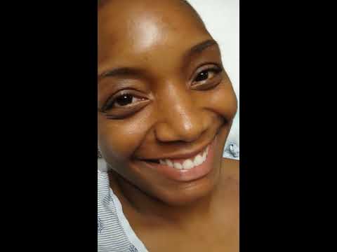 how to remove central line