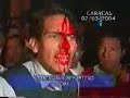 Venezuelan version of freedom of speech