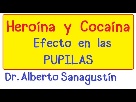 Síntomas de Intoxicación por Cocaína