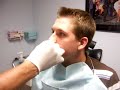 chris geting lip pierced
