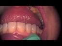 Filtek Supreme Plus D.D.S., M.B.A.,M.A.G.D.