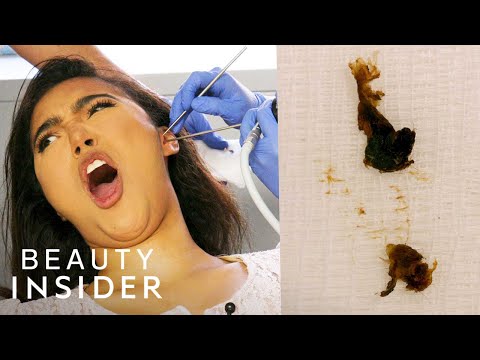 How Earwax Is Professionally Extracted | Beauty Explorers | Beauty Insider